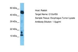 C10orf55 Rabbit anti-Human, Polyclonal, Novus Biologicals 0.1 mL | Buy Online | Novus Biologicals | Fisher Scientific